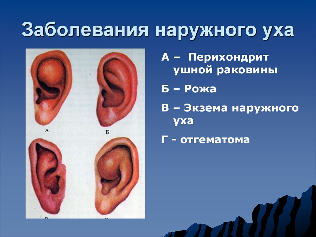 заболевание наружного уха